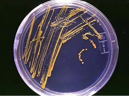 Aspiration of bacteria from the jejunum is the gold standard for diagnosis.  A bacterial load of greater than 105 bacteria per millilitre is diagnostic for bacterial overgrowth