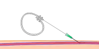 Step 2