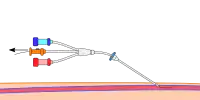 Step 5