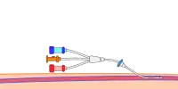 Step 6