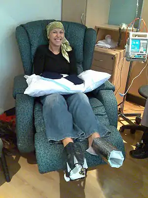 A woman being treated with docetaxel. Cold mittens are placed on her hands and feet to prevent deleterious effects on the nails. Similar strategies can be used to prevent hair loss.
