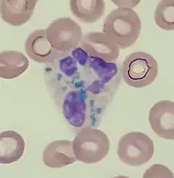 Critical green inclusions in a neutrophil