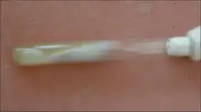 Sabouraud's dextrose agar showed cotton wool like colonies of Mucor