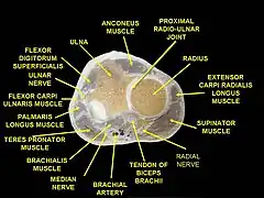 Muscles of forearm, including insertion of brachialis tendon. Cross section. (Brachialis labeled at bottom left.)