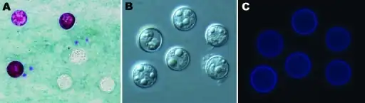 a-c)Cyclospora cayetanensis oocysts under  microscopy