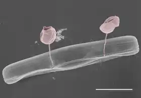 Pennate diatom from an Arctic meltpond, infected with two chytrid-like fungal pathogens. Scale bar = 10 µm.