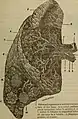 Diagrammatic view of lung showing magnified inner structures including alveolar sacs at 10) and lobules at 9)