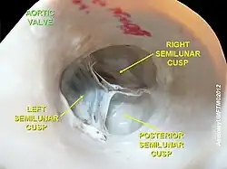 Aortic valve