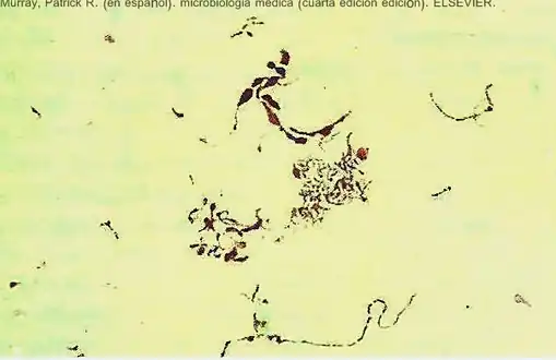 Streptobacillus moniliformis